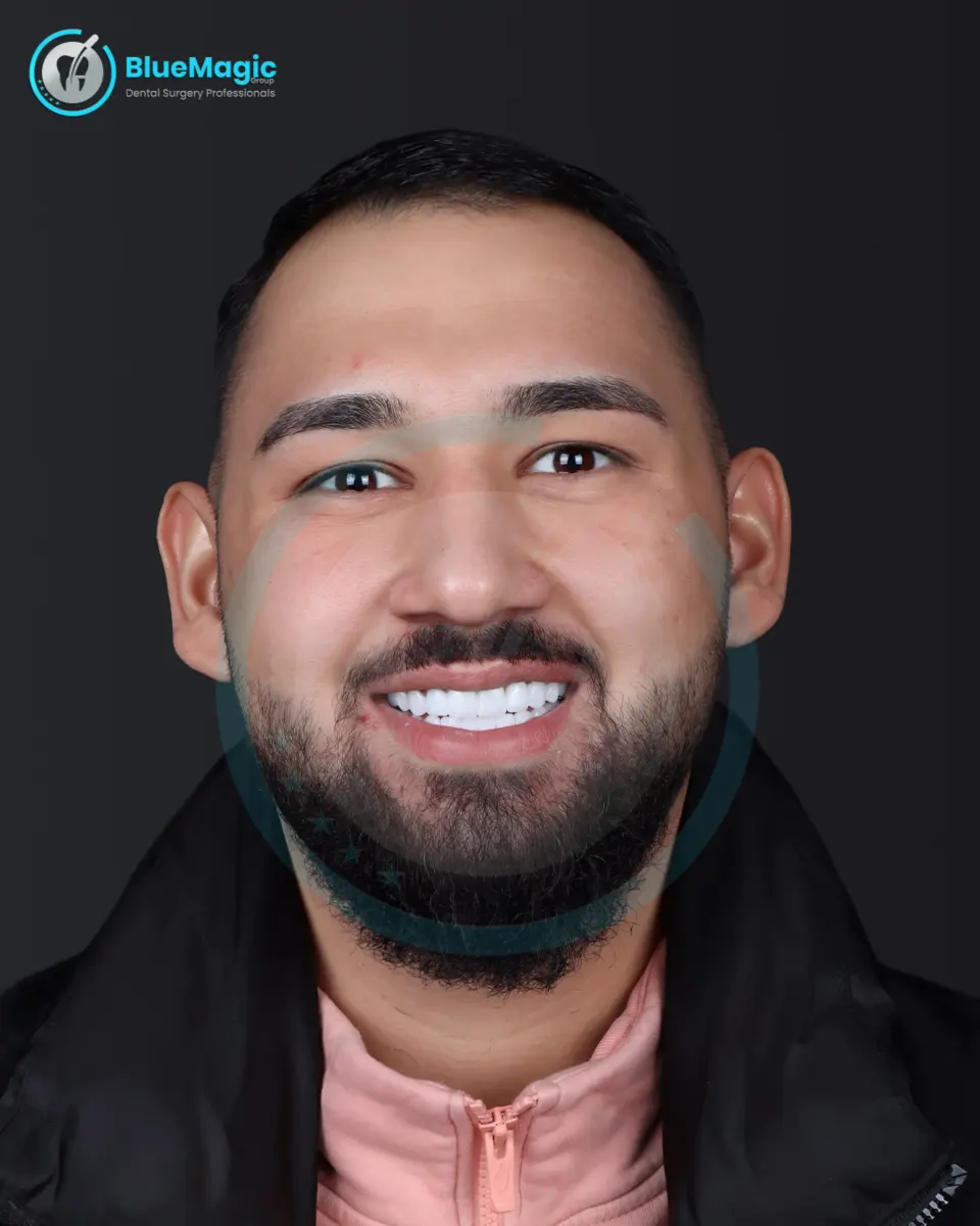 BlueMagic Group Dental patient with a natural, confident smile