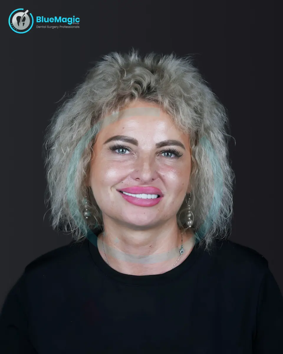 BlueMagic Group Dental patient with a restored smile