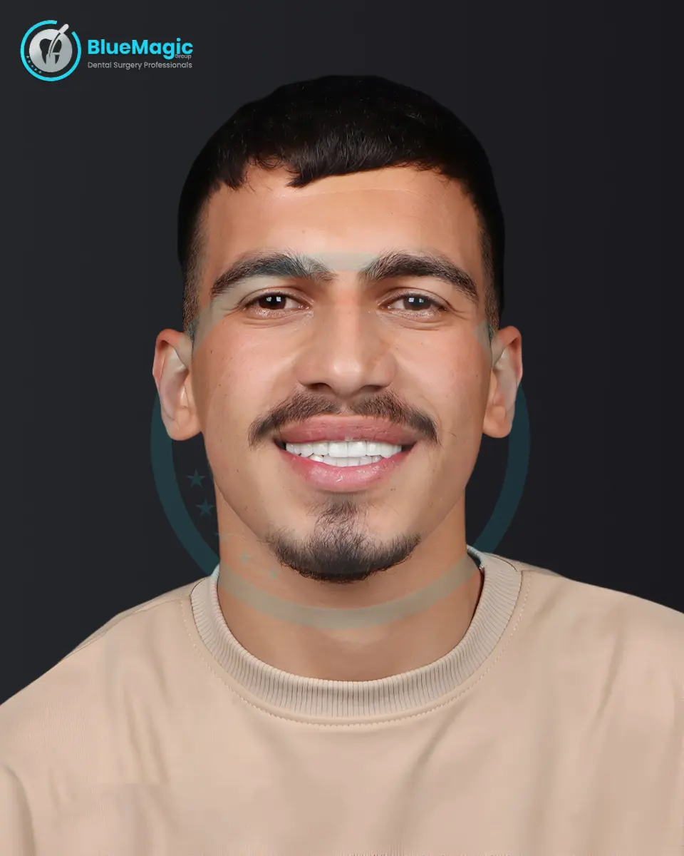 Teeth Whitening