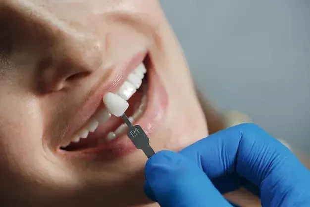 Close-up of a dentist's gloved hand holding a dental implant crown next to a smiling patient's teeth for a colour match.